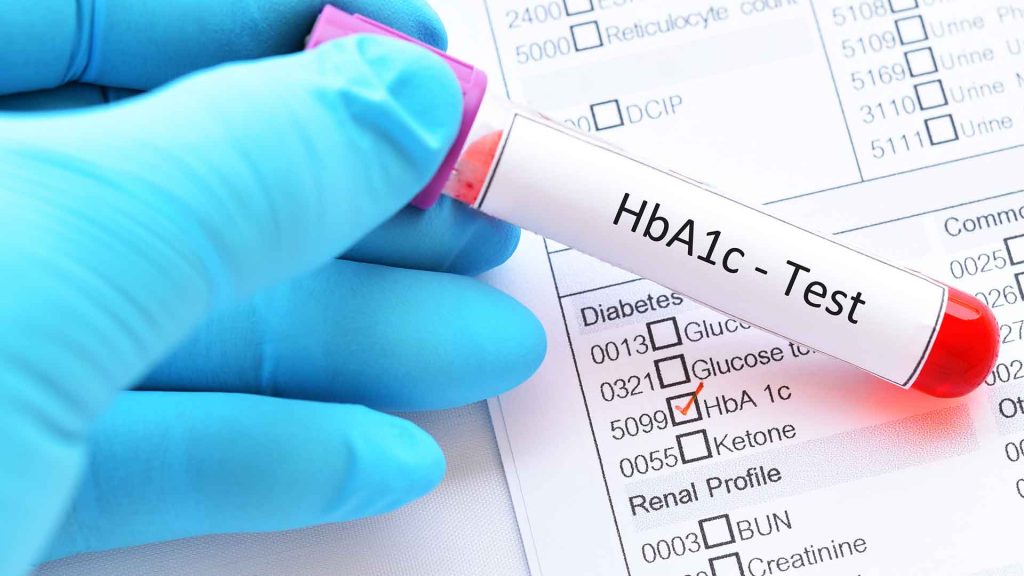 آزمایش HbA1c چیست