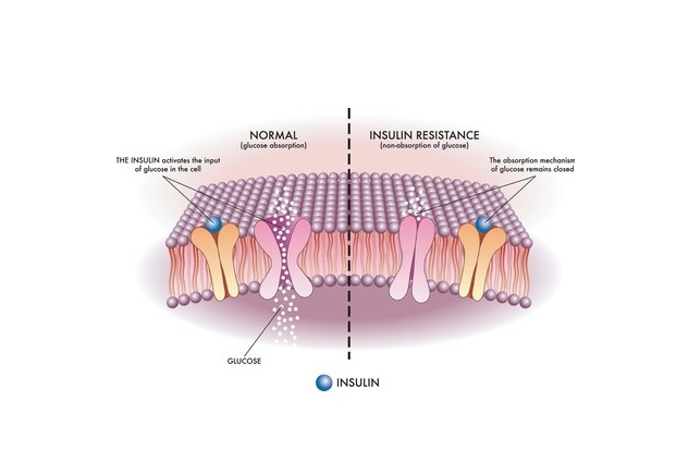 مقاومت به انسولین چیست؟